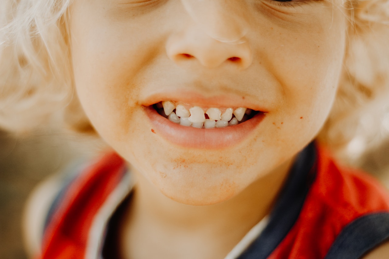 child with white teeth smiling