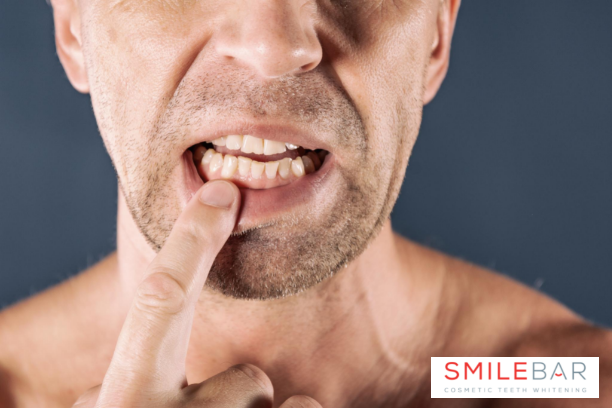 If you are ready to have your teeth whitened, don’t forget to make a checklist to avoid all these 14 mistakes!