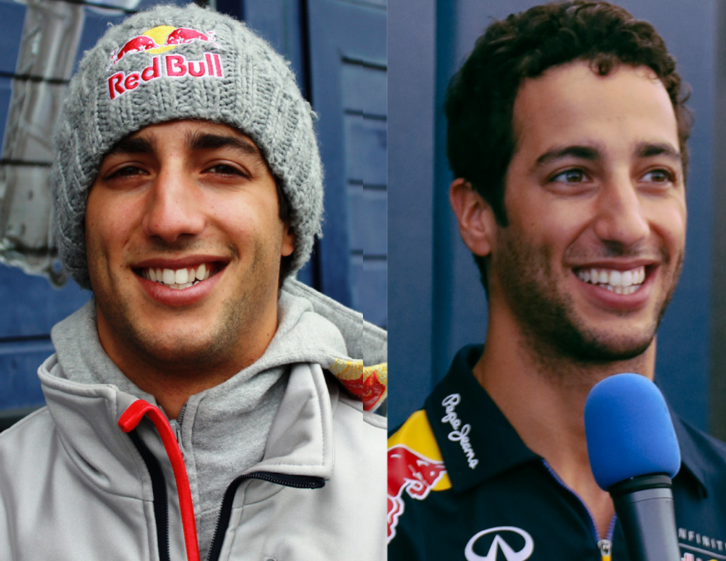 Ceramic braces are Daniel Ricciardo's secret weapon to be more confident on the race track