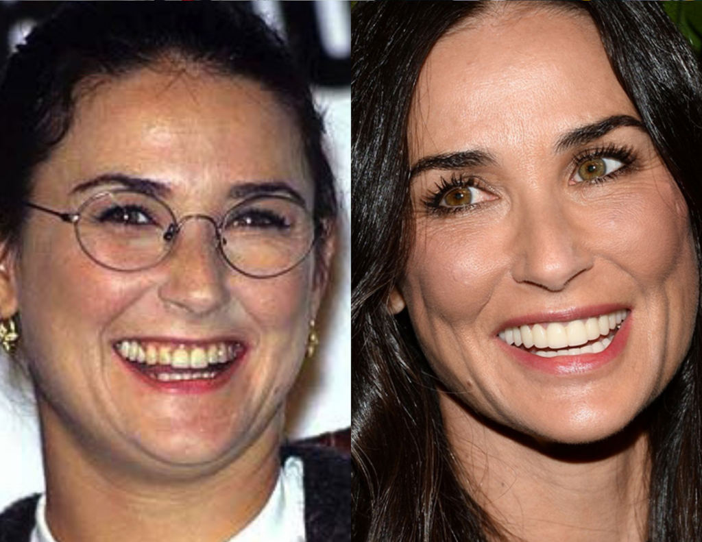 Now in her 50s, Demi Moore flashes a smile brighter than what she had she was younger