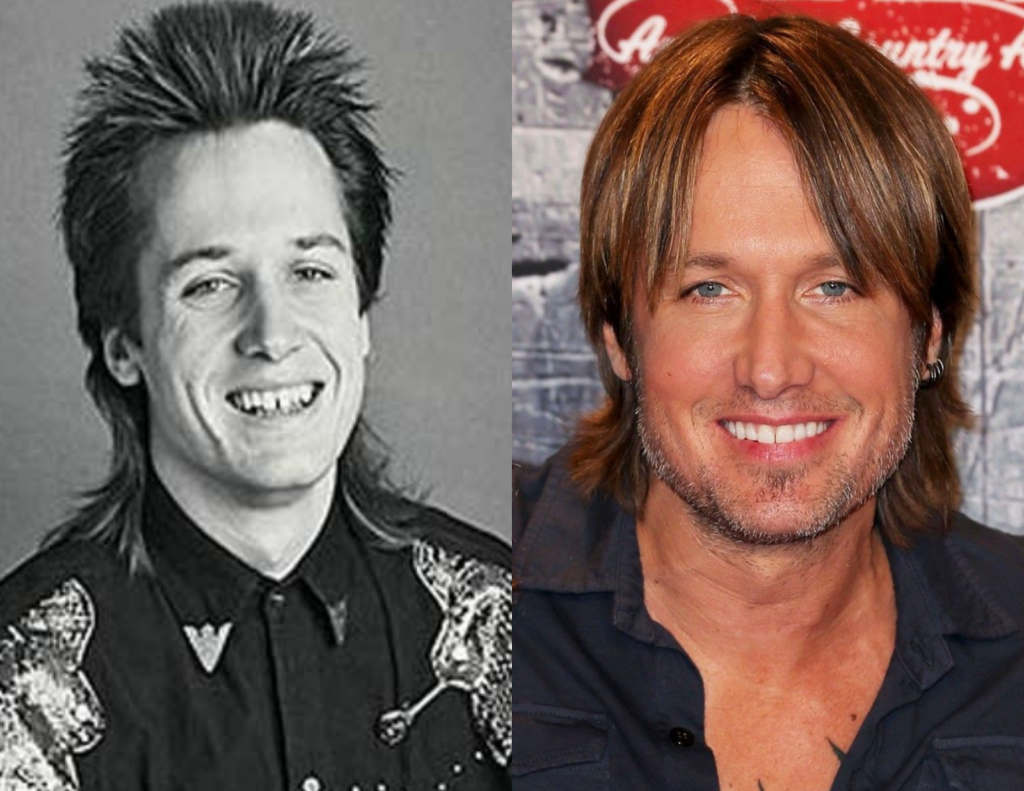 No more tooth gaps. Look at how Keith Urban's teeth have transformed