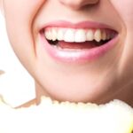 avoid eating coloured foods after teeth whitening