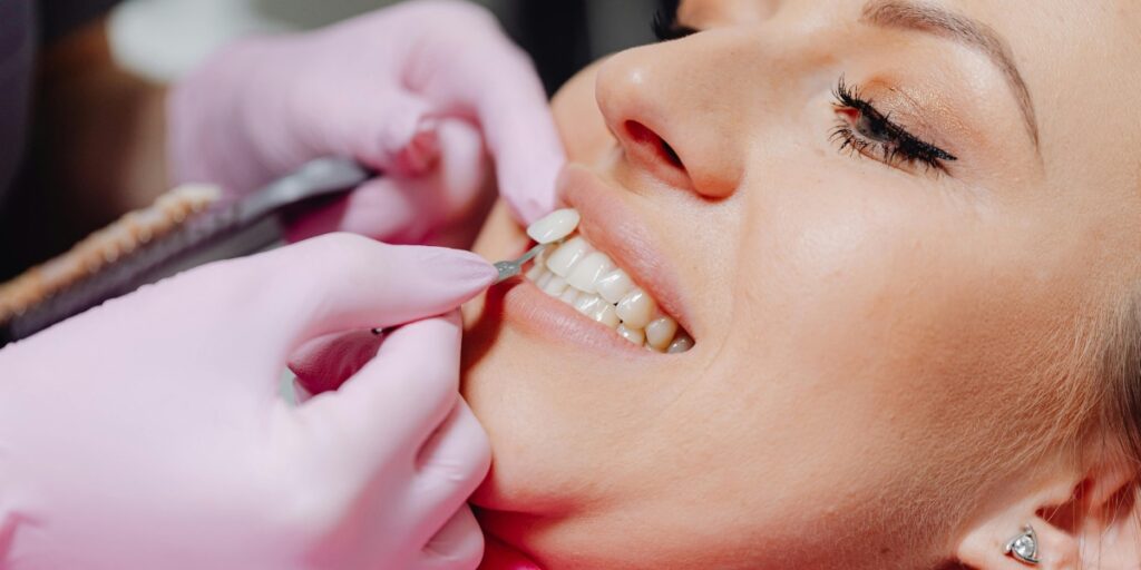 teeth whitening sessions
