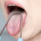 Is Tongue Scraping Good?